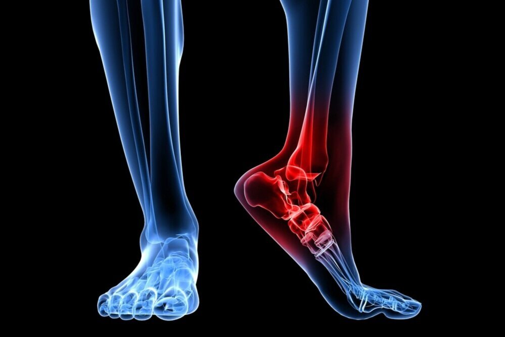 Foot & Ankle illustration