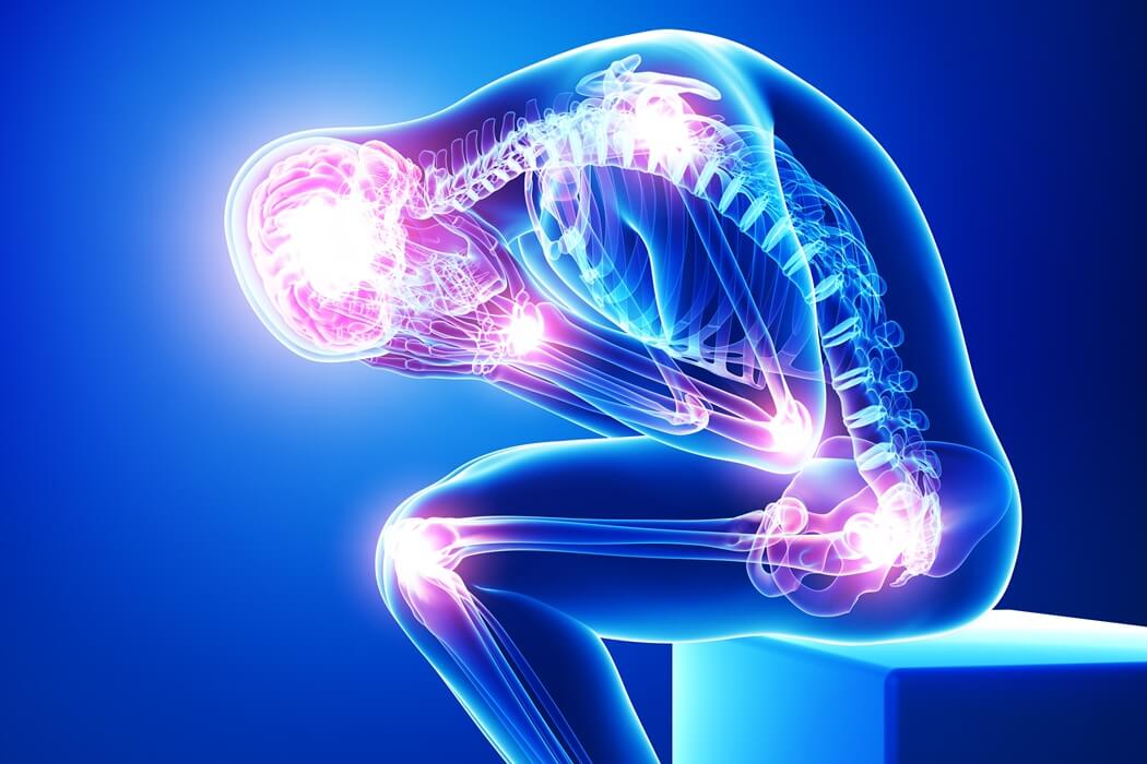 Chronic Pain illustration