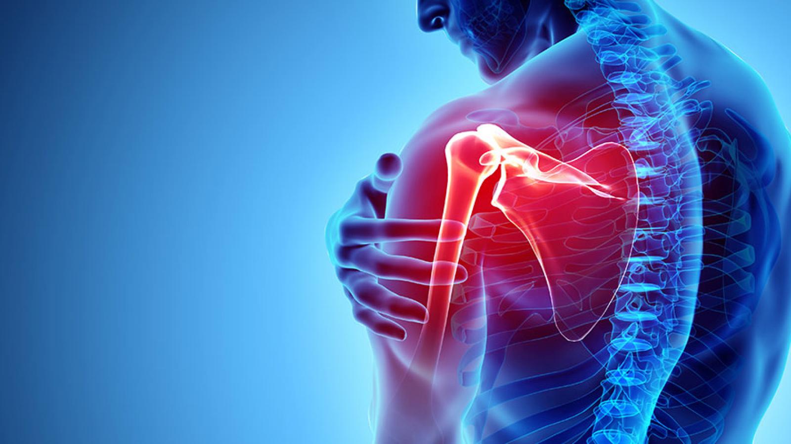 Shoulder Pain illustration