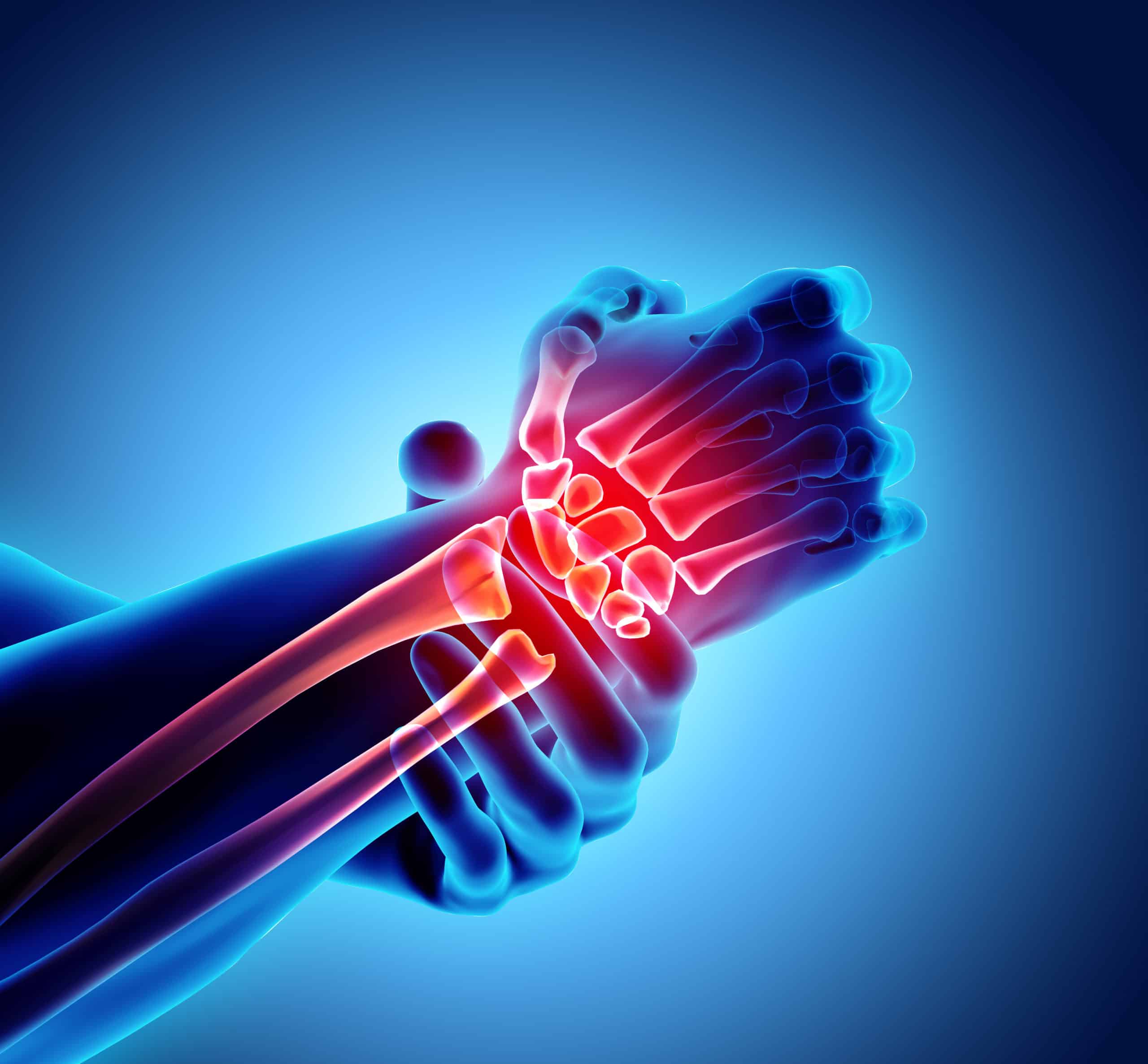 Wrist & Hand Pain illustration